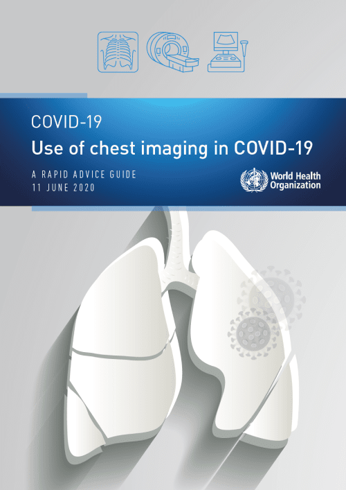 Use of Chest Imaging in COVID-19